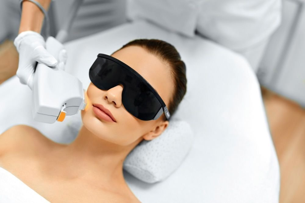 laser hair removal