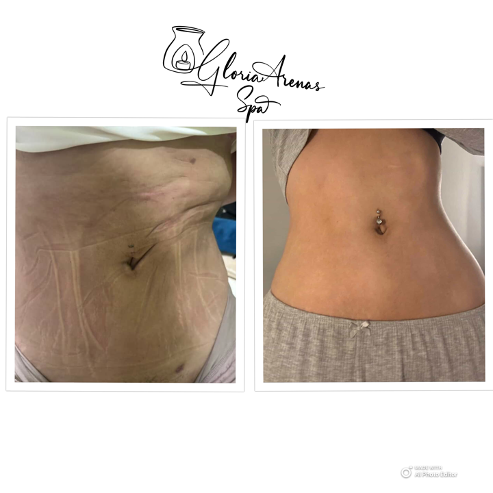 post care gloria spa